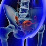 Couple Awarded Millions in Compensation Soon After Contracting Mesothelioma Cancer