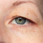 Enhancing Your Lips: Everything You Need To Know About Lip Filler
