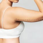 Dental Implant Stages: What to Expect When Getting Implant Surgery