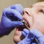 Dental Implant Professional Explained: Who Places Your Implants?
