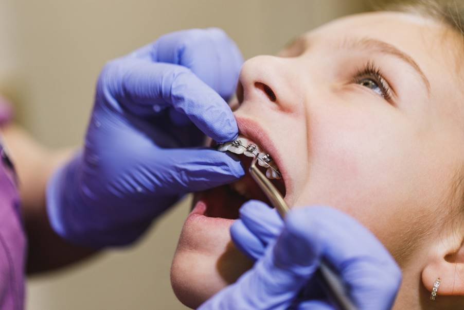 Understanding The Two-phase Orthodontic Treatment Process